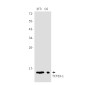 [KD]TCTEX-1 Rabbit mAb ABZ4767