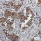[KD]Niemann Pick C2 Rabbit mAb ABZ4769