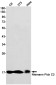 [KD]Niemann Pick C2 Rabbit mAb ABZ4769