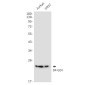 [KD]D4 GDI Rabbit mAb ABZ4773