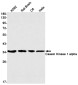 [KD]Casein Kinase 1 alpha Rabbit mAb ABZ4775
