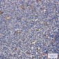 [KD]ATP6V1A Rabbit mAb ABZ4778