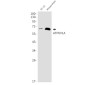 [KD]ATP6V1A Rabbit mAb ABZ4778