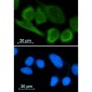 [KD]Annexin A1 Rabbit mAb ABZ4782