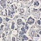 [KO]ARPC5/p16 ARC Rabbit mAb ABZ4783