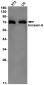 [KO]Annexin VI Rabbit mAb ABZ4785