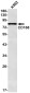 [KD]CD168 Rabbit mAb ABZ4787