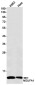 [KD]NDUFA1 Rabbit mAb ABZ4796