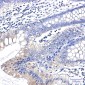 [KO]Clathrin Heavy Chain Rabbit mAb ABZ4803