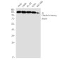 [KO]Clathrin Heavy Chain Rabbit mAb ABZ4803