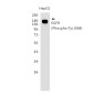 [KO]Phospho-EGFR (Tyr1068) Rabbit mAb ABZ4819