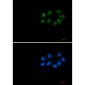 [KD]Phospho-Vimentin (Ser56) Rabbit mAb ABZ4820