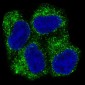 [KD]AMPK alpha 1 Rabbit mAb ABZ4821