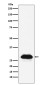 [KD]Carbonic Anhydrase 2 Rabbit mAb ABZ4825