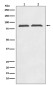 Axin 2 Rabbit mAb ABZ4828