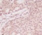 ATF5 Rabbit mAb ABZ4829