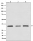 ATF5 Rabbit mAb ABZ4829