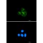 AKT Rabbit mAb ABZ4830