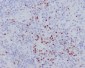 LEF1 Rabbit mAb ABZ4831