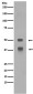 LEF1 Rabbit mAb ABZ4831