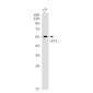 LEF1 Rabbit mAb ABZ4832