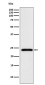 MAD2L2 Rabbit mAb ABZ4833