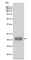 SMAC Rabbit mAb ABZ4840