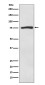 ACSS2 Rabbit mAb ABZ4841