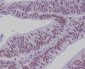 TCF4 Rabbit mAb ABZ4842
