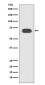 TCF4 Rabbit mAb ABZ4842