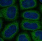 LC3A Rabbit mAb ABZ4843