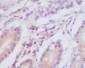 LC3A Rabbit mAb ABZ4843