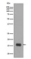 LC3A Rabbit mAb ABZ4843