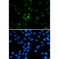 CDT1/DUP Rabbit mAb ABZ4844