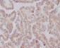KIFC1 Rabbit mAb ABZ4847