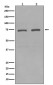 KIFC1 Rabbit mAb ABZ4847