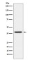 RING2 / RING1B / RNF2 Rabbit mAb ABZ4851