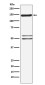 SynGAP Rabbit mAb ABZ4854