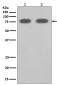 SR-BI Rabbit mAb ABZ4861