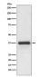 Podoplanin Rabbit mAb ABZ4862