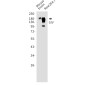 GIV Rabbit mAb ABZ4867