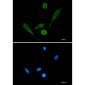 Fascin Rabbit mAb ABZ4869