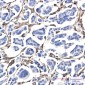 Fascin Rabbit mAb ABZ4869