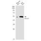 Fascin Rabbit mAb ABZ4869