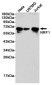 NRF1 Rabbit mAb ABZ4870
