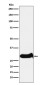 IGFBP7 Rabbit mAb ABZ4873