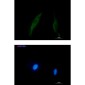 Smad2/3 Rabbit mAb ABZ4875