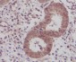 IKB beta Rabbit mAb ABZ4877
