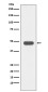 IKB beta Rabbit mAb ABZ4877