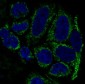 TOMM20 Rabbit mAb ABZ4878